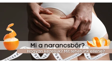 A nők egyik legnagyobb ellensége - A narancsbőr